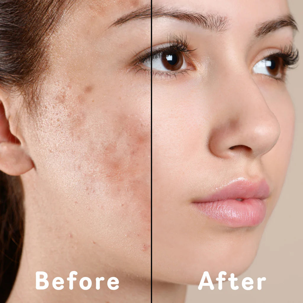 Glow Soap – Turmeric & Kojic Acid Formula
